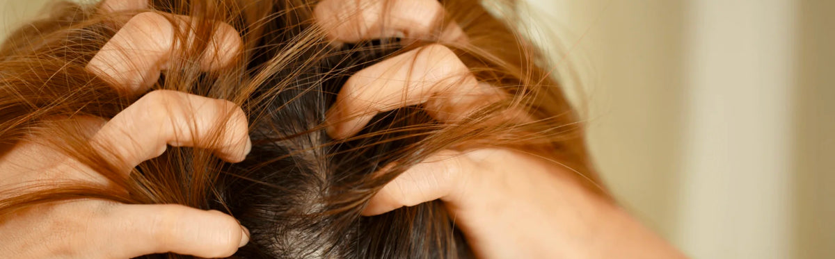 Remède contre les boutons sur le cuir chevelu : Solutions naturelles